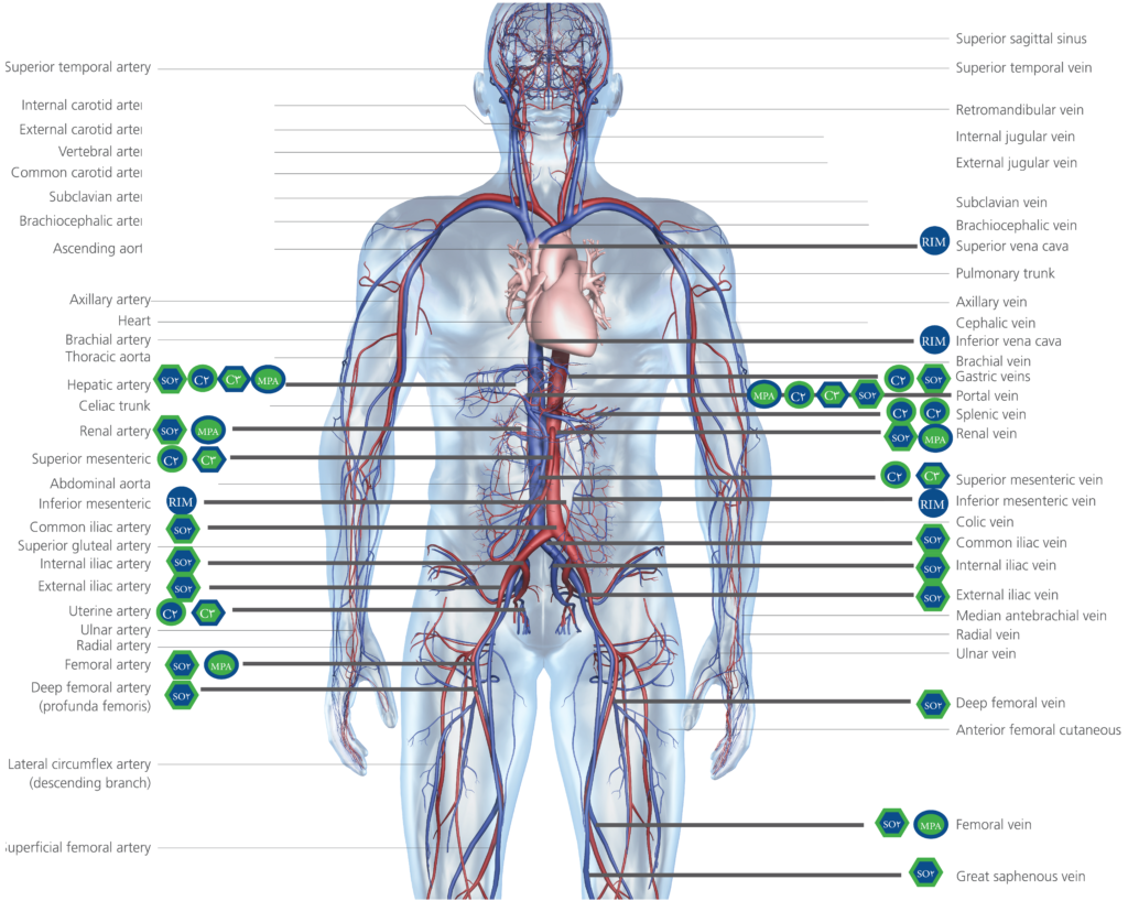 Catheters in different parts of the body